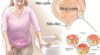 Bệnh viêm niệu đạo: Khái niệm, nguyên nhân, biểu hiện, điều trị, cách phòng ngừa 20