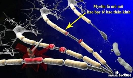 Bệnh xơ cứng rải rác: Khái niệm, nguyên nhân, triệu chứng,điều trị và cách phòng ngừa Bệnh xơ cứng rải rác: Khái niệm, nguyên nhân, triệu chứng,điều trị và cách phòng ngừa