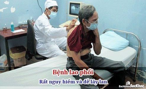 Bệnh lao phổi: Khái niệm, nguyên nhân, biểu hiện, điều trị, cách phòng ngừa 27 Tình trạng lao phổi ngày càng nhiều