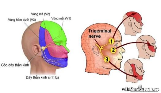 Bệnh dây thần kinh tam thoa: Khái niệm, nguyên nhân, triệu chứng, điều trị và cách phòng ngừa 9