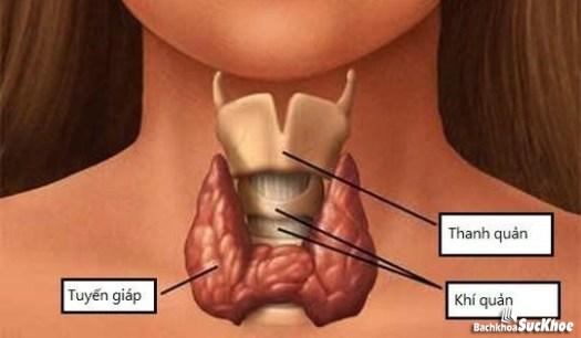 Bệnh u nang tuyến giáp: Khái niệm, nguyên nhân, triệu chứng, phòng ngừa 26 Bệnh u nang tuyến giáp là gì?