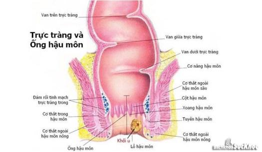 Bệnh ung thư hậu môn trực tràng: Khái niệm, nguyên nhân, biểu hiện, điều trị, cách phòng ngừa 1 Ung thư hậu môn trực tràng là bệnh gì?