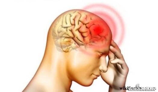 Bệnh viêm màng não mô cầu: Khái niệm, nguyên nhân, triệu chứng, phòng ngừa 26 Bệnh viêm màng não mô cầu