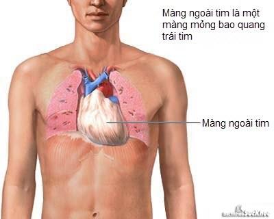 Bệnh viêm màng ngoài tim: Khái niệm, nguyên nhân, triệu chứng,điều trị và cách phòng ngừa 11