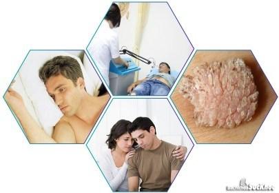Bệnh xã hội: Khái niệm, nguyên nhân, triệu chứng, phòng ngừa 26 Bệnh xã hội là gì?