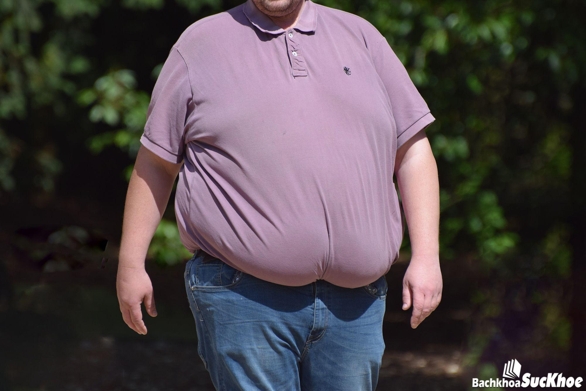 Bệnh béo phì: Khái niệm, nguyên nhân, triệu chứng, phòng ngừa 26 Obese Brits may be forced to stay home after lockdown lifted