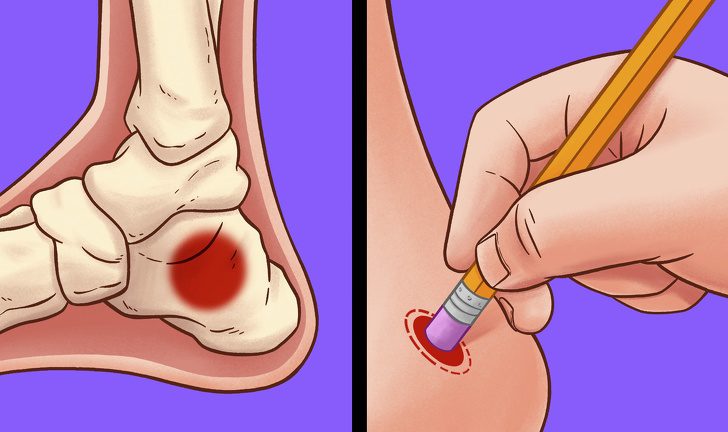 Trị mỏi chân và bàn chân bằng những mẹo đơn giản tại nhà Trị mỏi chân và bàn chân bằng những mẹo đơn giản tại nhà